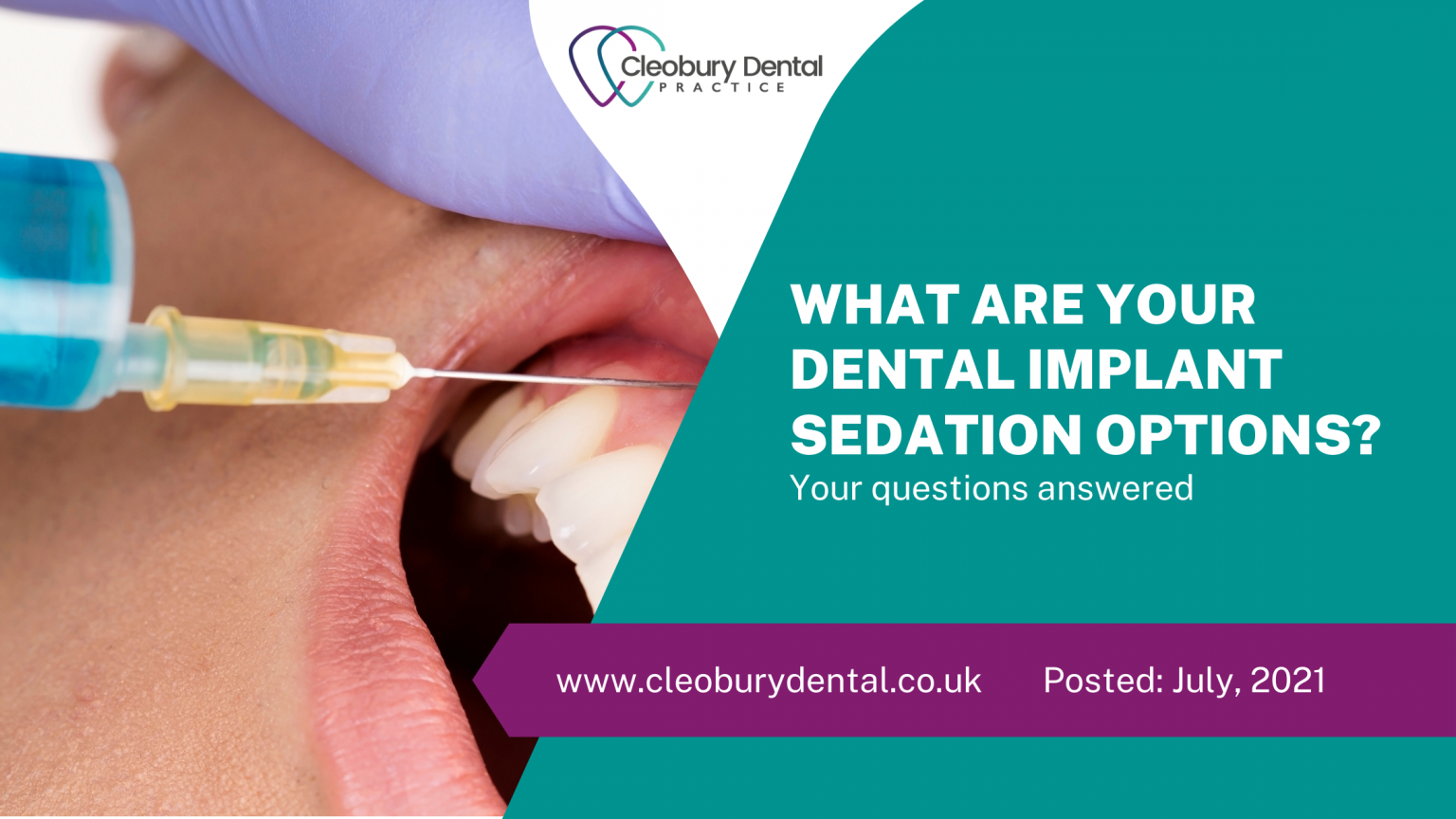 What Are Your Dental Implant Sedation Options?
